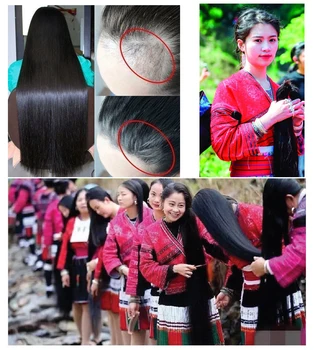 Yeni Pirinç Saç Büyüme Şampuanı Anti Saç Dökülmesi Tedavisi Serum Hızlı Büyüme Uzun kalın Saç Erkekler Kadınlar için En İyi saç bakım ürünü
